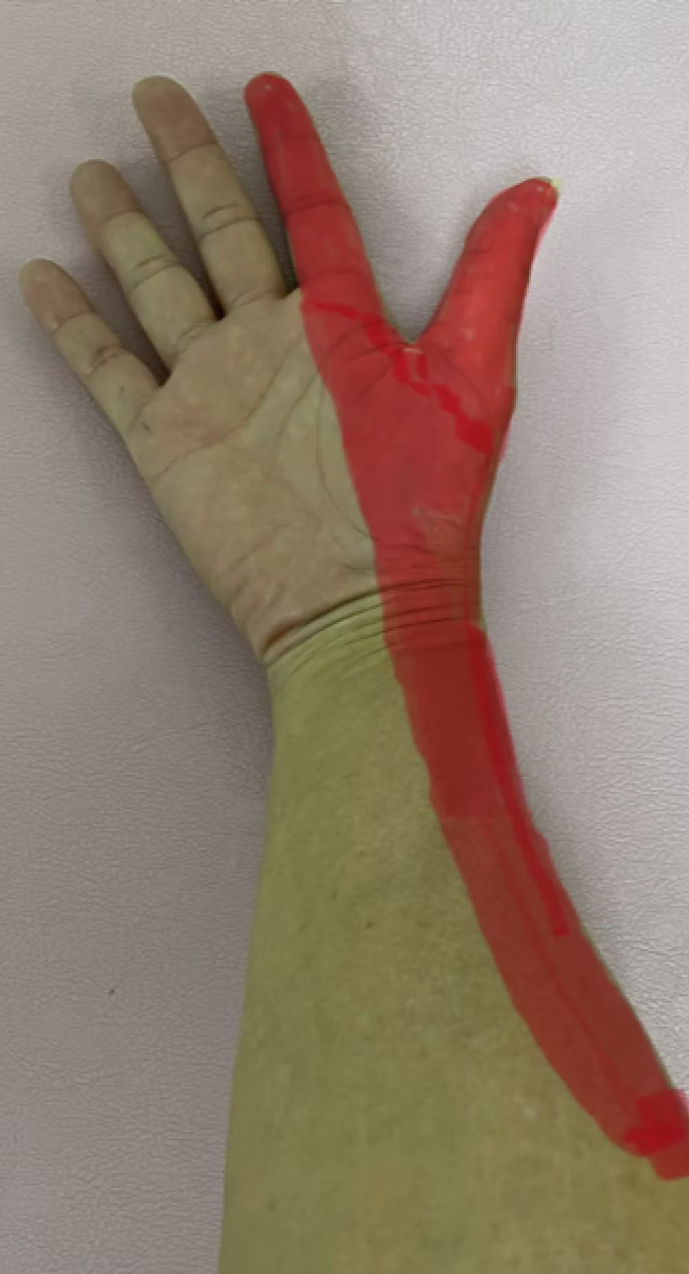 肩こり、腕や手のしびれ
