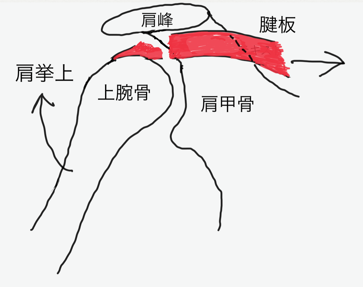 五十肩か腱板炎か?